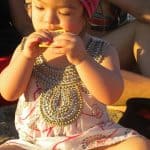 רשלנות רפואית תסמונת דאון